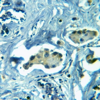 19 - Anti-GLUR2 Antibody AP59569