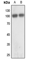 1 - Anti-GLUR2 Antibody AP59569