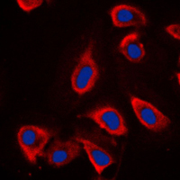 3 - Anti-mGLUR6 Antibody AP59571