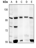 1 - Anti-mGLUR6 Antibody AP59571