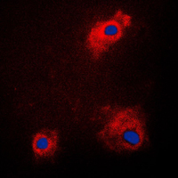 3 - Anti-GSK3 alpha (Phospho-S21) Antibody AP59572