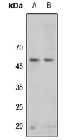 1 - Anti-GSK3 alpha (Phospho-S21) Antibody AP59572