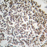 19 - Anti-GYS1 Antibody [KO/KD Validated] AP59576