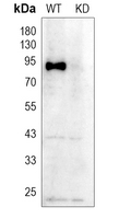 0 - Anti-GYS1 Antibody [KO/KD Validated] AP59576