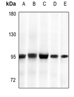1 - Anti-GYS1 Antibody [KO/KD Validated] AP59576