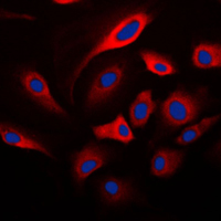 3 - Anti-HADH2 Antibody AP59577