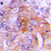 19 - Anti-HADH2 Antibody AP59577