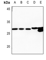 1 - Anti-HADH2 Antibody AP59577