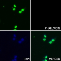 3 - Anti-Histone Deacetylase 1 (Phospho-S421) Antibody AP59578
