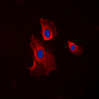 3 - Anti-Histamine H2 Receptor Antibody AP59581