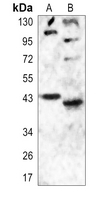 1 - Anti-Histamine H2 Receptor Antibody AP59581