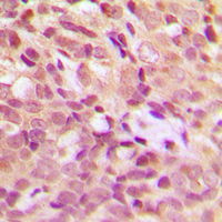 19 - Anti-HSP27 (Phospho-S15) Antibody AP59582