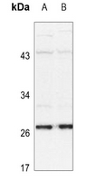 1 - Anti-HSP27 (Phospho-S15) Antibody AP59582
