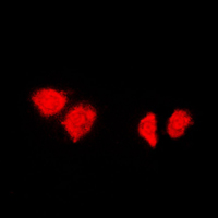 3 - Anti-HSP40 Antibody AP59583