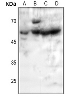 1 - Anti-5-HT2B Antibody AP59584