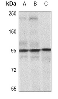 1 - Anti-IGF1 Receptor (Phospho-Y1165/Y1166) Antibody AP59585
