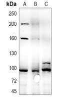 1 - Anti-IGF1 Receptor Antibody AP59586