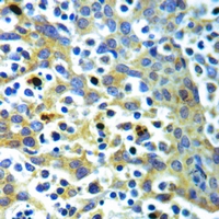 19 - Anti-IL-4 Antibody AP59588