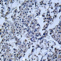 19 - Anti-IL-12B Antibody AP59589