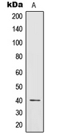 1 - Anti-IL-12B Antibody AP59589