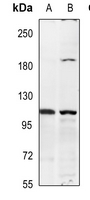 1 - Anti-Insulin Receptor Antibody AP59590