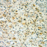 19 - Anti-IRAK1 (Phospho-T209) Antibody AP59591