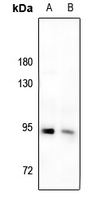 1 - Anti-IRAK1 (Phospho-T209) Antibody AP59591