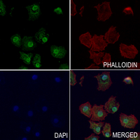 3 - Anti-IRS1 (Phospho-S1101) Antibody AP59592