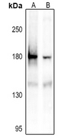 1 - Anti-IRS1 (Phospho-S1101) Antibody AP59592