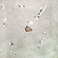 19 - Anti-CD51 Antibody AP59594