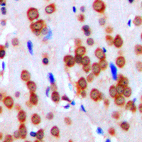 19 - Anti-CD51 HC Antibody [KO/KD Validated] AP59595