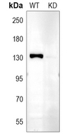 0 - Anti-CD51 HC Antibody [KO/KD Validated] AP59595
