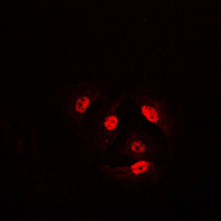3 - Anti-Cofilin (Phospho-S3) Antibody AP59597