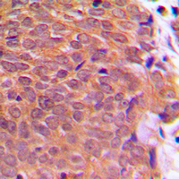 19 - Anti-Cofilin (Phospho-S3) Antibody AP59597