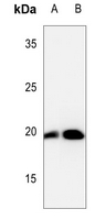 1 - Anti-Cofilin (Phospho-S3) Antibody AP59597