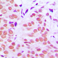 19 - Anti-c-Jun (Phospho-T91) Antibody AP59599