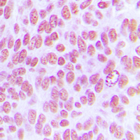 19 - Anti-c-Jun (Phospho-Y170) Antibody AP59600
