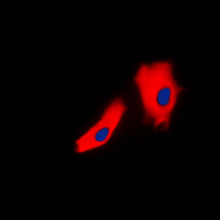 3 - Anti-Gamma-catenin Antibody AP59601