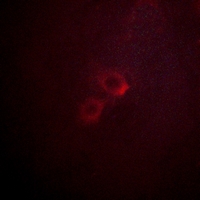 3 - Anti-Kv1.3 Antibody AP59602