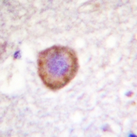 19 - Anti-Kv1.3 Antibody AP59602
