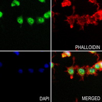 3 - Anti-Cytokeratin 8 (Phospho-S73) Antibody AP59603