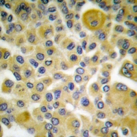 19 - Anti-Cytokeratin 8 (Phospho-S73) Antibody AP59603