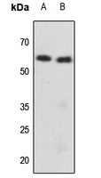 1 - Anti-Cytokeratin 8 (Phospho-S73) Antibody AP59603