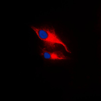 3 - Anti-LCK (Phospho-Y393) Antibody AP59604