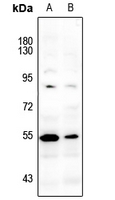 1 - Anti-LCK (Phospho-Y393) Antibody AP59604