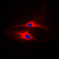 3 - Anti-LCK Antibody AP59605