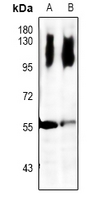 1 - Anti-LCK Antibody AP59605
