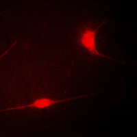 3 - Anti-LIMK1 Antibody AP59606