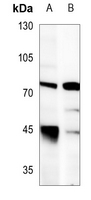 1 - Anti-LIMK1 Antibody AP59606