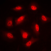 3 - Anti-LIMK1/2 (Phospho-T508/505) Antibody AP59607